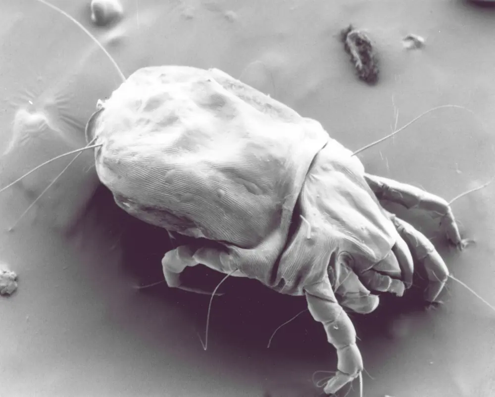 Imagem de capa do artigo: Alergia aos ácaros do pó doméstico na infância