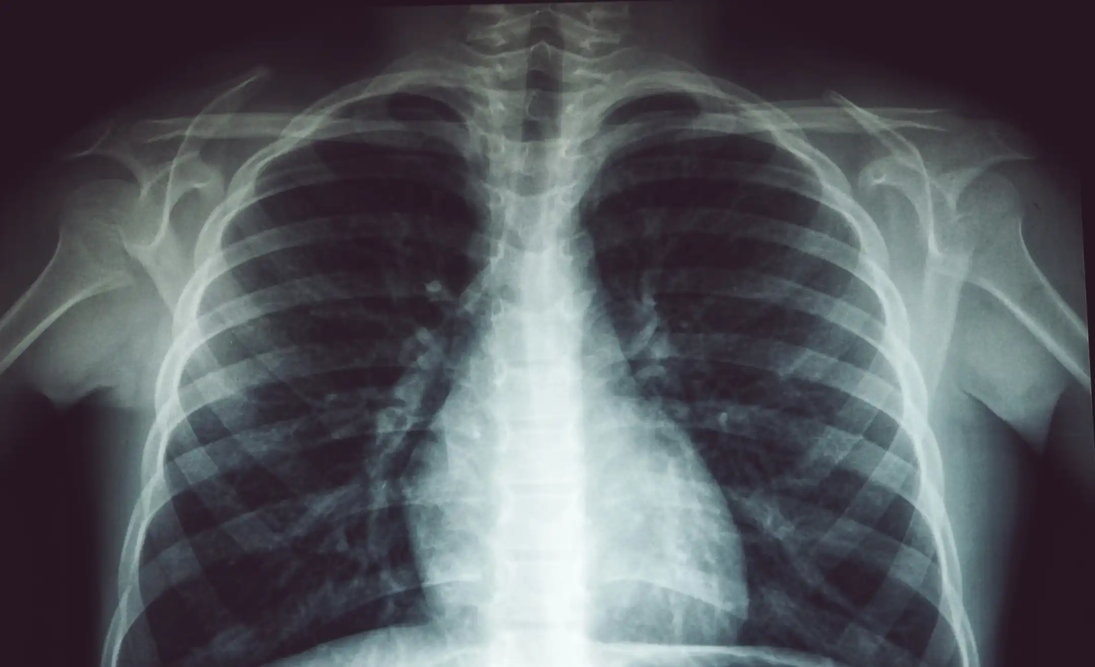 As grávidas podem fazer exames com raios X?